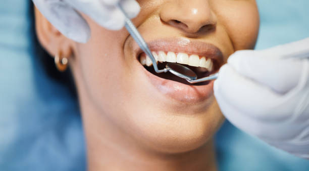 Best Emergency Dentist for Special Needs Patients in Newpt, OR